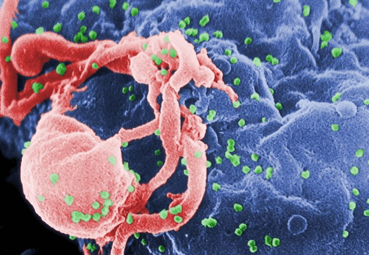 Vírus HIV tornou-se indetectável em exames de paciente britânico Foto: Latinstock.